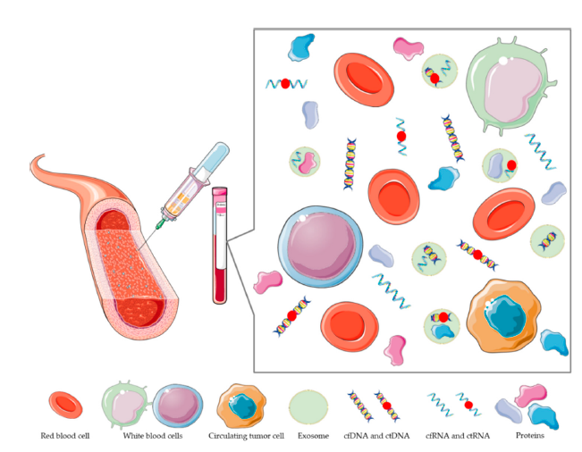 Nanomedicine and Immunotherapy: A  Step Further towards Precision Medicine   for Glioblastoma