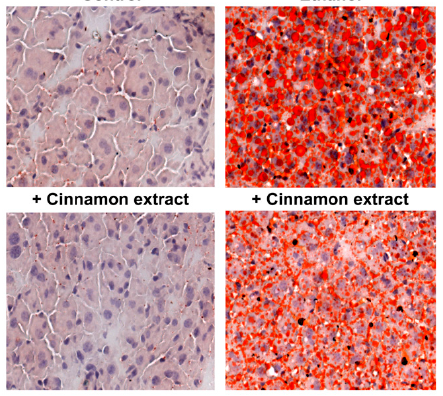 Cinnamon Extract Protects against Acute Alcohol-Induced Liver Steatosis in Mice